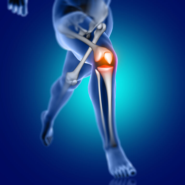 Joint Pain treatment in hyderabad